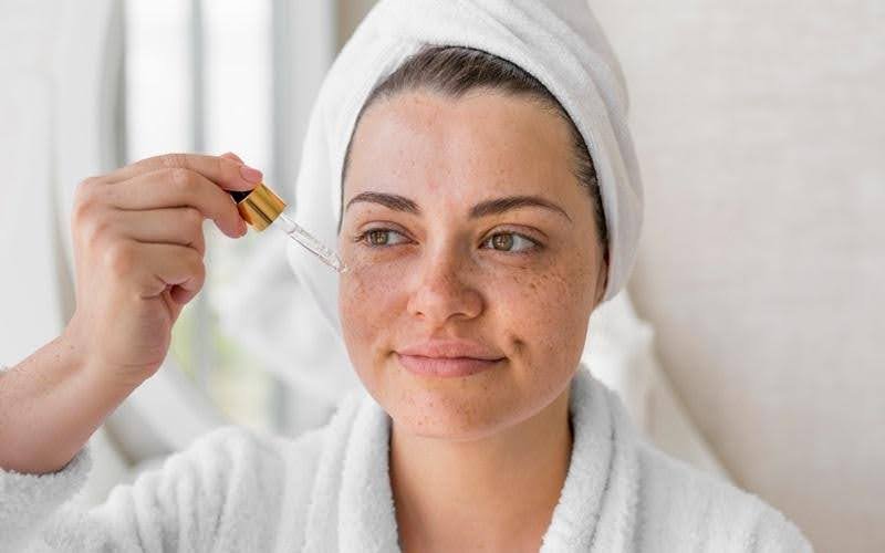 Why Acne Control Serums Are Essential for Clear Skin